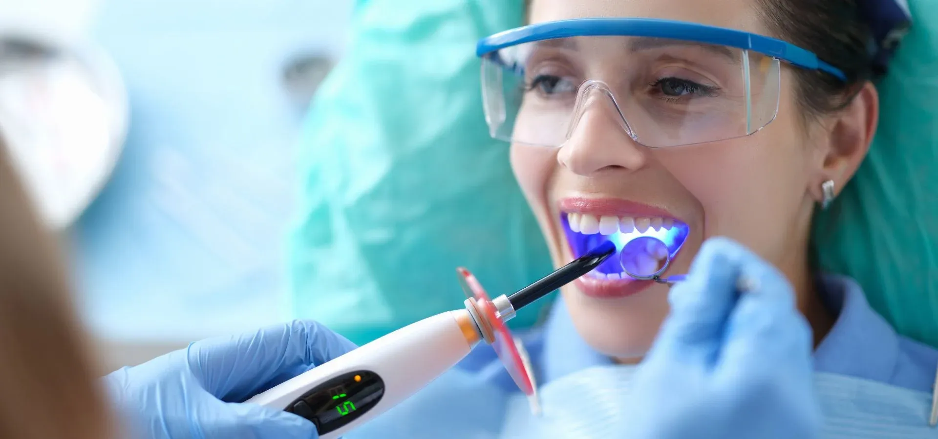 Tooth-Colored Fillings: editorial image from Legacy Care