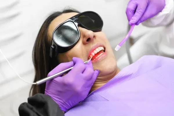 Laser Teeth Whitening: editorial image from Legacy Care