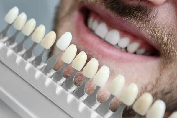 Zirconia Veneers: editorial image from Legacy Care
