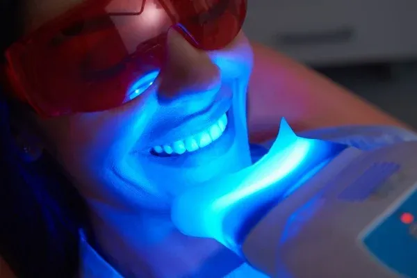 In-Office Whitening: editorial image from Legacy Care