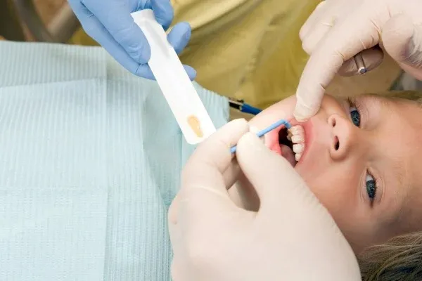 Fluoride Treatments: editorial image from Legacy Care