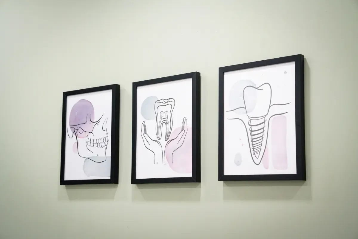 Framed dental illustrations in the Legacy Care clinic