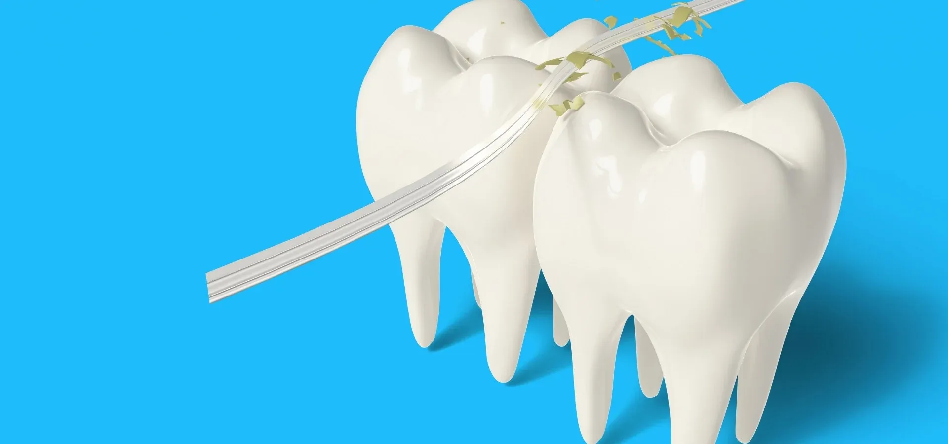 Inlays and Onlays: editorial image from Legacy Care