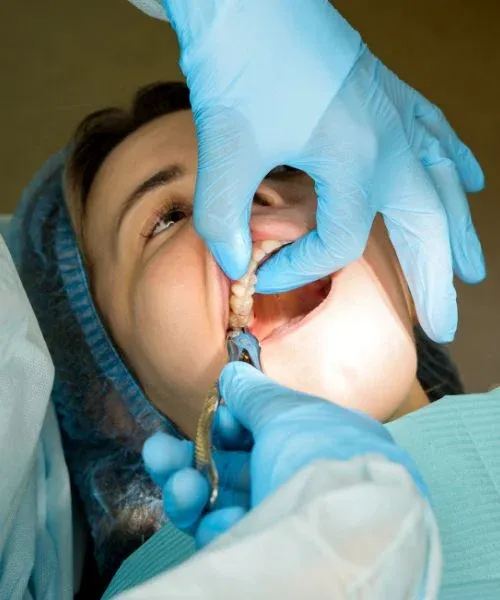 Tooth Extraction: editorial image from Legacy Care