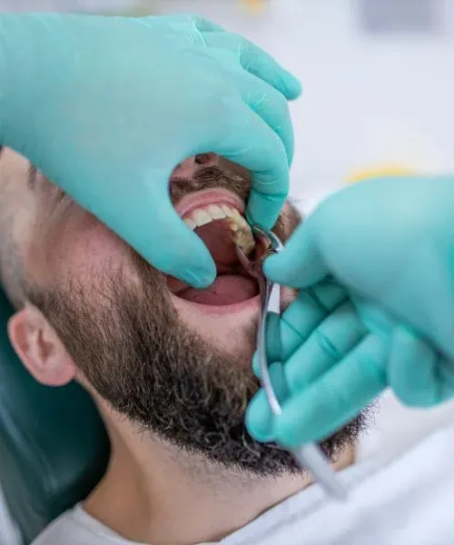 Wisdom Tooth Extraction: editorial image from Legacy Care